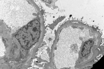 Allograft kidney图1