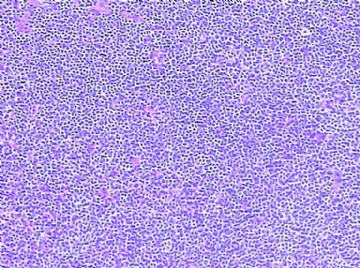 请教：良性？恶性？灰区？图4