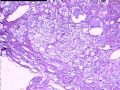 甲状腺图2
